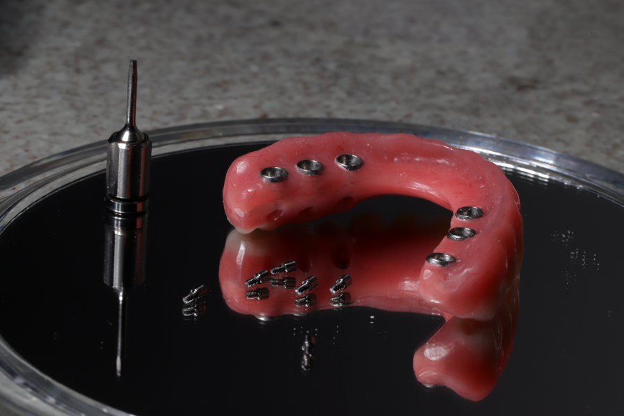 Reabilitação estética — prótese sobre implantes