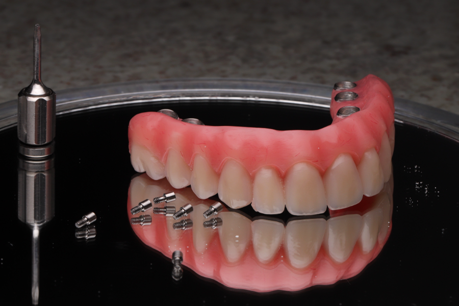 Reabilitação estética — prótese finalizada